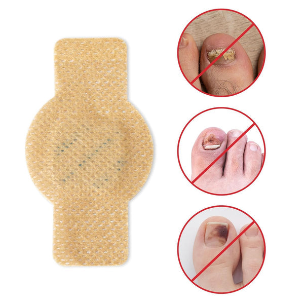 NailHeal™ - Fungal Nail Patches 🌿💅 ( Buy 10 Get 10 Free🔥🔥)